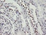 TLE1 Antibody in Immunohistochemistry (Paraffin) (IHC (P))