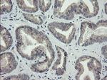 ARL2BP Antibody in Immunohistochemistry (Paraffin) (IHC (P))