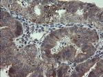 ARL2BP Antibody in Immunohistochemistry (Paraffin) (IHC (P))