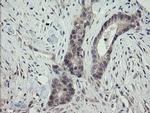 ARL2BP Antibody in Immunohistochemistry (Paraffin) (IHC (P))