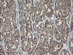 ARL2BP Antibody in Immunohistochemistry (Paraffin) (IHC (P))