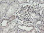 ARL2BP Antibody in Immunohistochemistry (Paraffin) (IHC (P))