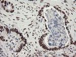 TLE1 Antibody in Immunohistochemistry (Paraffin) (IHC (P))