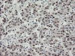 TLE1 Antibody in Immunohistochemistry (Paraffin) (IHC (P))