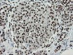 TLE1 Antibody in Immunohistochemistry (Paraffin) (IHC (P))