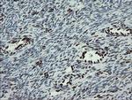 TLE1 Antibody in Immunohistochemistry (Paraffin) (IHC (P))