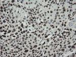 TLE1 Antibody in Immunohistochemistry (Paraffin) (IHC (P))