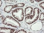 TLE1 Antibody in Immunohistochemistry (Paraffin) (IHC (P))