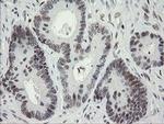 TLE1 Antibody in Immunohistochemistry (Paraffin) (IHC (P))