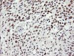 TLE1 Antibody in Immunohistochemistry (Paraffin) (IHC (P))