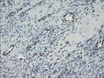 TLE1 Antibody in Immunohistochemistry (Paraffin) (IHC (P))