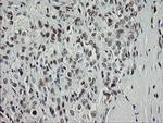 TLE1 Antibody in Immunohistochemistry (Paraffin) (IHC (P))