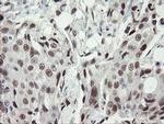 TLE1 Antibody in Immunohistochemistry (Paraffin) (IHC (P))