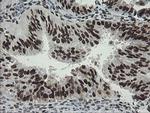 TLE1 Antibody in Immunohistochemistry (Paraffin) (IHC (P))