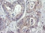 RIP1 Antibody in Immunohistochemistry (Paraffin) (IHC (P))