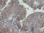 RIP1 Antibody in Immunohistochemistry (Paraffin) (IHC (P))