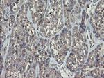 RIP1 Antibody in Immunohistochemistry (Paraffin) (IHC (P))