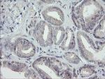 RIP1 Antibody in Immunohistochemistry (Paraffin) (IHC (P))