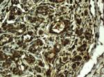 RIP1 Antibody in Immunohistochemistry (Paraffin) (IHC (P))