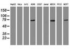 RIP1 Antibody in Western Blot (WB)