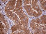 IDH1 Antibody in Immunohistochemistry (Paraffin) (IHC (P))