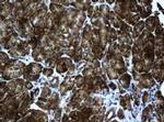 ACADS Antibody in Immunohistochemistry (Paraffin) (IHC (P))