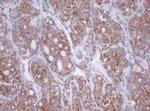 MTIF3 Antibody in Immunohistochemistry (Paraffin) (IHC (P))