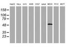 ZSCAN4 Antibody in Western Blot (WB)