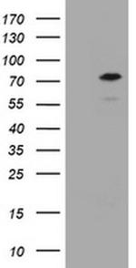 CCDC93 Antibody in Western Blot (WB)