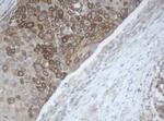 MAGEB1 Antibody in Immunohistochemistry (Paraffin) (IHC (P))