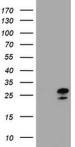 ZFAND5 Antibody in Western Blot (WB)