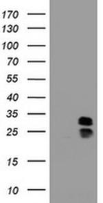 PPT1 Antibody in Western Blot (WB)