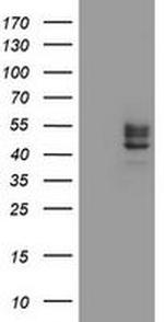 CHST6 Antibody in Western Blot (WB)