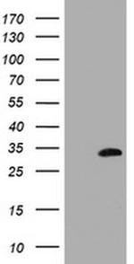 MMADHC Antibody in Western Blot (WB)