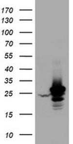 HSD17B8 Antibody in Western Blot (WB)