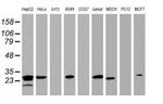 HSD17B8 Antibody in Western Blot (WB)