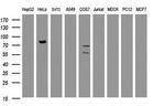 HBS1L Antibody in Western Blot (WB)