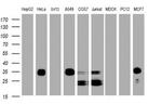 PPT1 Antibody in Western Blot (WB)