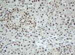 SF3A1 Antibody in Immunohistochemistry (Paraffin) (IHC (P))