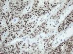 SF3A1 Antibody in Immunohistochemistry (Paraffin) (IHC (P))