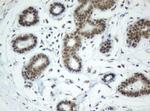 SF3A1 Antibody in Immunohistochemistry (Paraffin) (IHC (P))