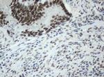 SF3A1 Antibody in Immunohistochemistry (Paraffin) (IHC (P))