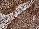 SERBP1 Antibody in Immunohistochemistry (Paraffin) (IHC (P))