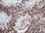 SERBP1 Antibody in Immunohistochemistry (Paraffin) (IHC (P))