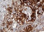 SERBP1 Antibody in Immunohistochemistry (Paraffin) (IHC (P))