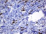 HOXD10 Antibody in Immunohistochemistry (Paraffin) (IHC (P))