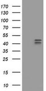 HOXD10 Antibody in Western Blot (WB)