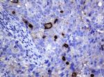 MAGEA3 Antibody in Immunohistochemistry (Paraffin) (IHC (P))