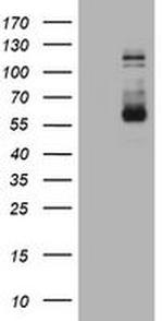 FGFR3 Antibody in Western Blot (WB)