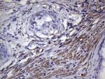 VEGFC Antibody in Immunohistochemistry (Paraffin) (IHC (P))